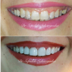 مرکز دندانپزشکی زیبایی و مدرن دکتر سحر گشا