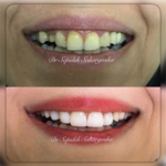 مرکز دندانپزشکی زیبایی و مدرن دکتر سحر گشا