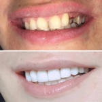 مرکز دندانپزشکی زیبایی و مدرن دکتر سحر گشا