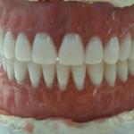 لابراتوار دندانسازی تضمینی 