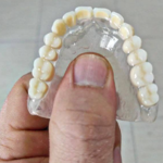 دندانسازی آرمان