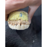 دندانسازی آرمان