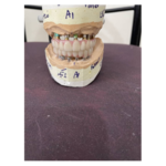 دندانسازی آرمان