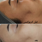 مرکز مراقبت پوست و مو  قیطانی