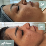 مرکز مراقبت پوست و مو  قیطانی