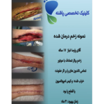 کلینیک زخم پاشنه