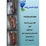 کلینیک زخم پاشنه