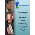 کلینیک زخم پاشنه