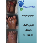 کلینیک زخم پاشنه