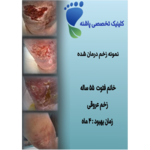 کلینیک زخم پاشنه