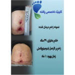 کلینیک زخم پاشنه