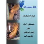 کلینیک زخم پاشنه