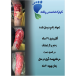 کلینیک زخم پاشنه