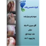 کلینیک زخم پاشنه