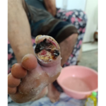 کارشناس زخم سعید شه سلام