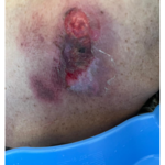 کارشناس تخصصی زخم و استومی  بهاره برجی 