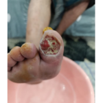 کارشناس تخصصی زخم و استومی  بهاره برجی 