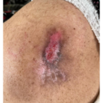 کارشناس تخصصی زخم و استومی  بهاره برجی 