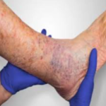 کارشناس تخصصی زخم و استومی  بهاره برجی 