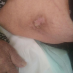 کارشناس تخصصی زخم و استومی  بهاره برجی 