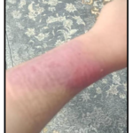 کارشناس تخصصی زخم و استومی  بهاره برجی 