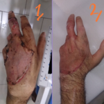 مرکز درمان تخصصی زخم ساعت