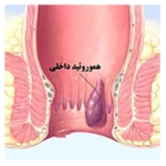 متخصص جراحی عمومی لاپاراسکوپی دکتر حسین تاروردی زاده 
