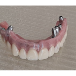 لابراتوار تخصصی پروتزهای دندانی مفید