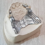 لابراتوار تخصصی پروتزهای دندانی مفید