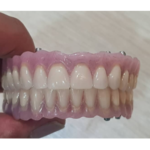 لابراتوار تخصصی پروتزهای دندانی مفید