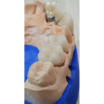 لابراتوار تخصصی پروتزهای دندانی مفید