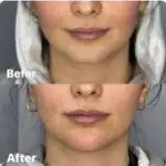 کلینیک زیبایی و لیزر نومیا