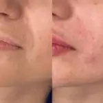 کلینیک زیبایی و لیزر نومیا