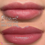 کلینیک زیبایی و لیزر رایکا