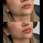 کلینیک زیبایی و لیزر نومیا