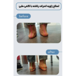 کلینیک ارتوپدی فنی رادمان