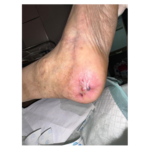 درمانگر زخم حسن یوسفی