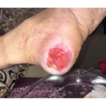 درمانگر زخم حسن یوسفی