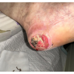 درمانگر زخم حسن یوسفی