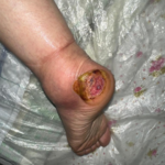 درمانگر زخم حسن یوسفی