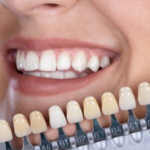 کلینیک دندانپزشکی نیکا