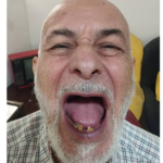 لابراتوار پروتز های دندانی متحرک نجات