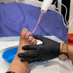 درمانگر زخم ناصر سلمانی