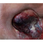 درمانگر زخم ناصر سلمانی