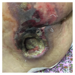 درمانگر زخم ناصر سلمانی