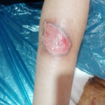 درمانگر زخم ناصر سلمانی