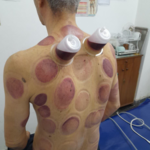 مرکز طب سنتی و حجامت اسدی