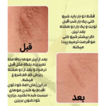 مرکز لیزر باران