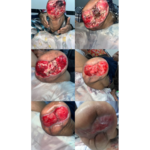 کارشناش زخم و  استوما سجاد فروزان مهر