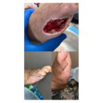 کارشناش زخم و  استوما سجاد فروزان مهر